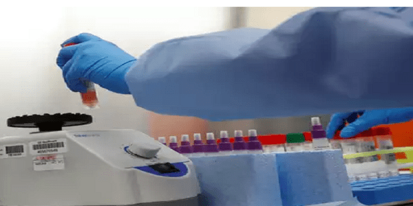 কেজরিওয়ালের নির্দেশে কমানো হোল ‘RT-PCR’ টেস্টের দাম ~ স্বস্তি আমজনতার……